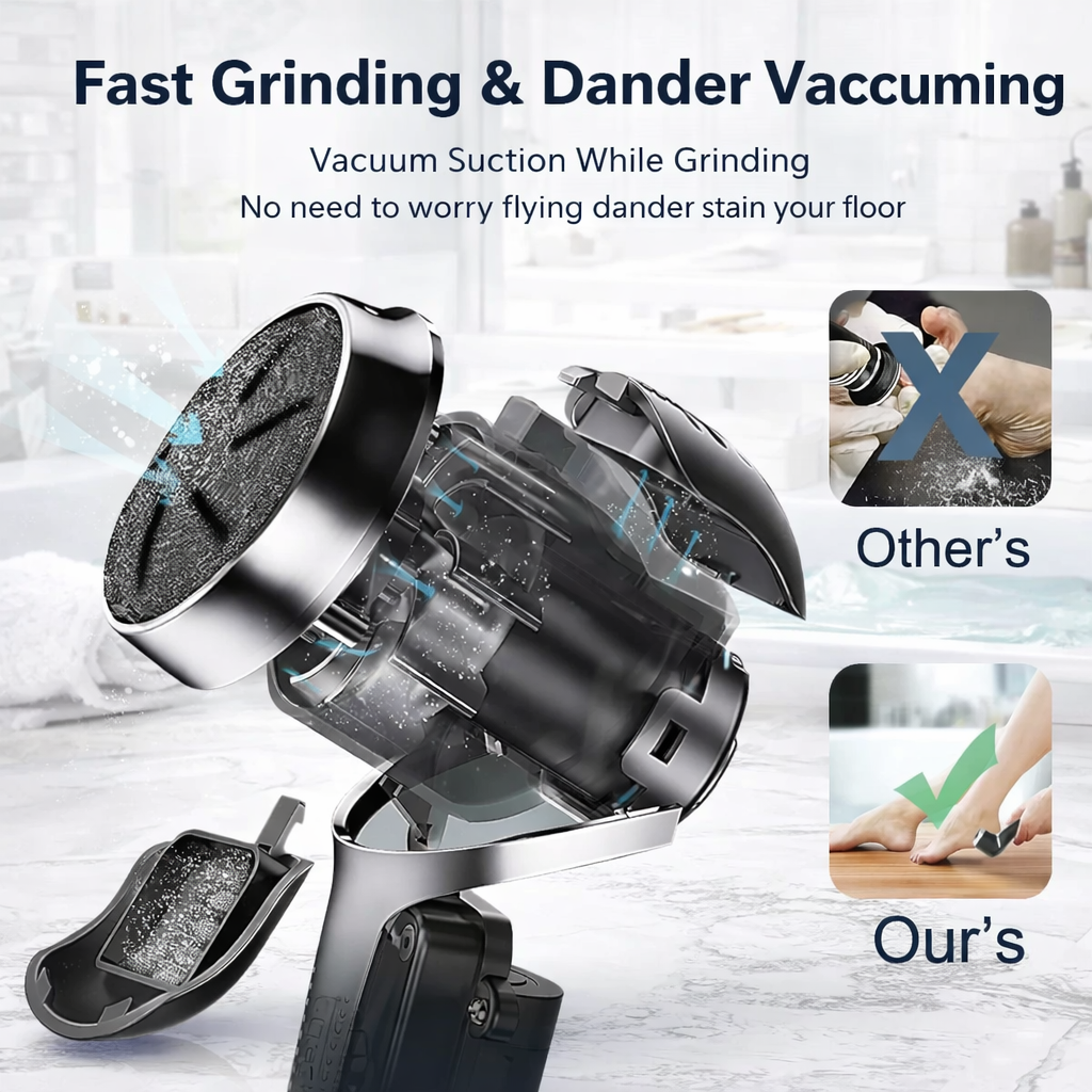 Electric Foot Callus Remover with Vacuum & 2 Speeds